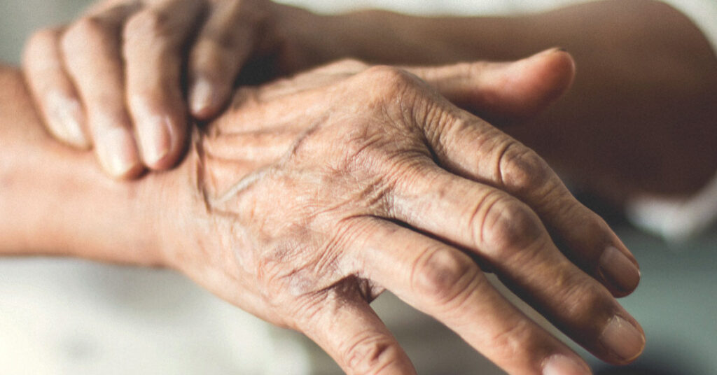 El Parkinson, una silenciosa enfermedad neurodegenerativa
