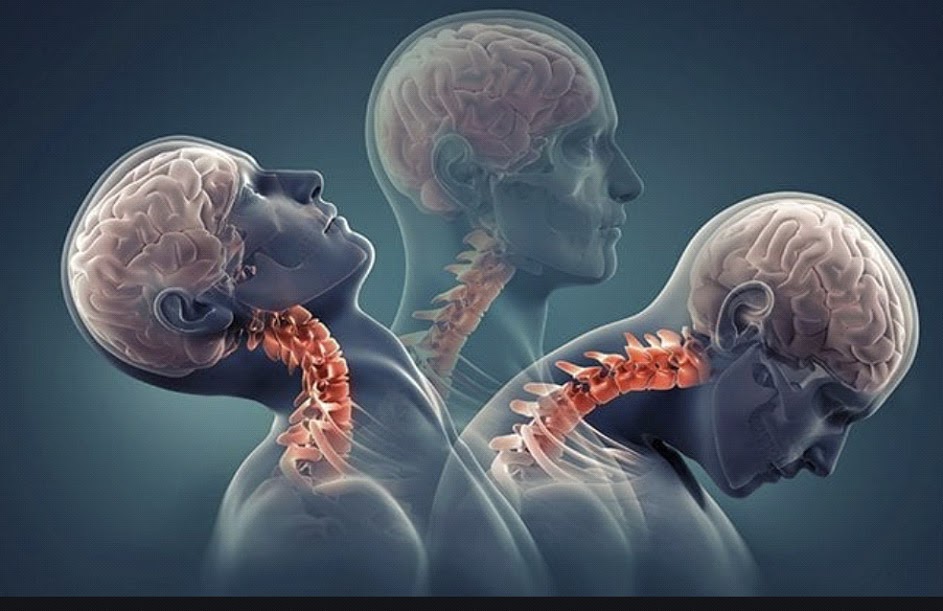 El latigazo cervical, una lesión típica del verano